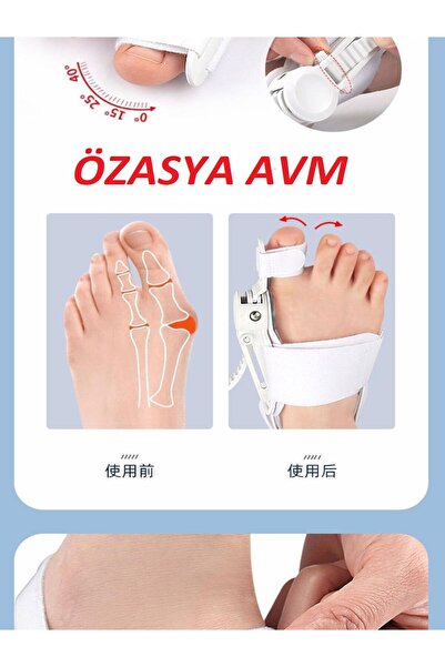 Özasya AVM Ayarlı Ayak Baş Parmak Kemik Düzeltici Başparmak Eğriliği Düzeltme Gece ATELİ