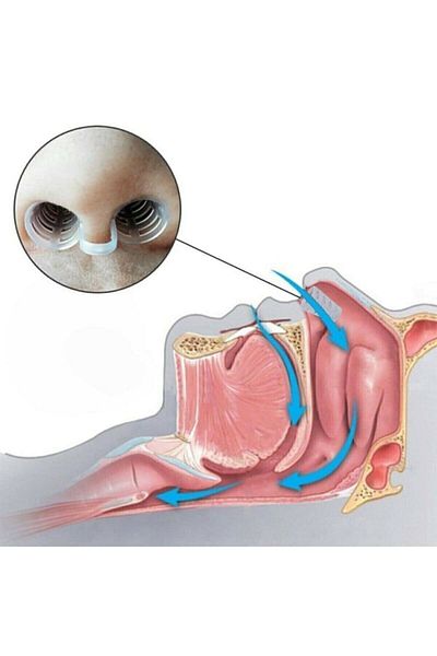 CKV CENTER 3 قطع من شبكة الأنف المضادة للشخير، جهاز سيليكون داخلي للتنفس
