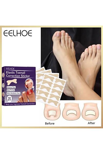 MOR SALKIM HOME Ayak Tırnağı Düzeltme Bandı 20 adet