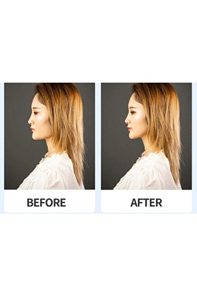 lasting beauty Kaş Germe Göz Germe Yüz Gerdirme Ipli Toka Çekik Göz