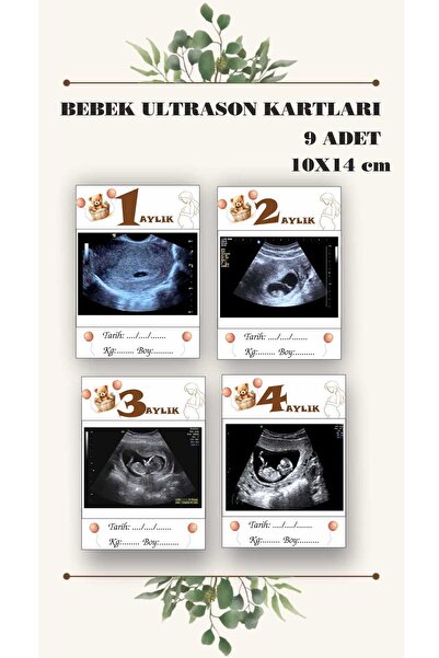 ZY TASARIM 9 kartica za ultrazvuk beba - 10x14 cm