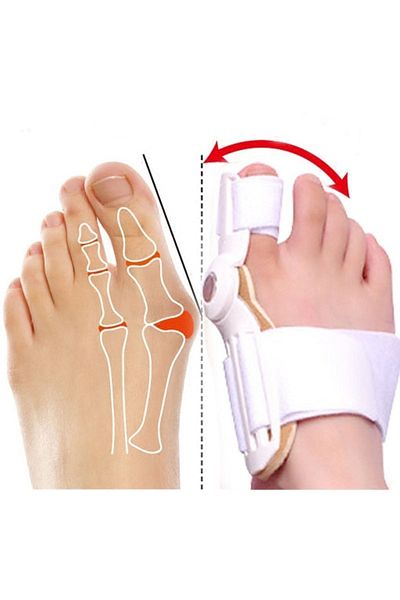 Reidan Orthopedics Foot Corrector - Big Toe and Bone Adjuster, Correction Foot Separator