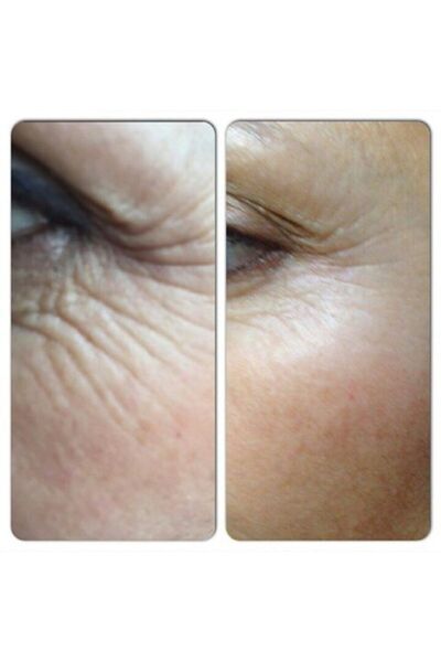 LR Zeıtgard Serox Eye Pads - Göz Pedleri -