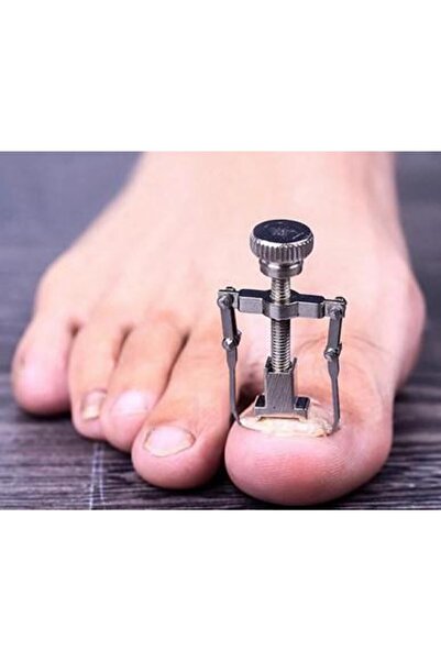 Genel Markalar Ayak Tırnak Batması Ağrısı İçin Batık Tırnak Çıkartıcı Aparat