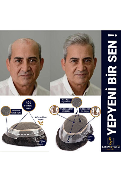 SP Sacprotezim Protez Saç Avustralya 6x10 Renk 1b %40 Beyazlı Ince Telli Her ...