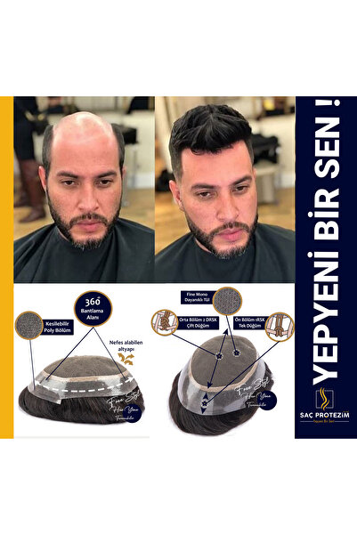 SP Sacprotezim Protez Saç Avustralya 6x9 %30 Beyazlı Ince Telli Her Yöne Tara...