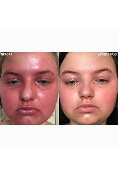 Beauty Box Premium Spf 25 Sun Protection - Anti-Chapped Cream, Skin Soothing, Vegan Moisturizer