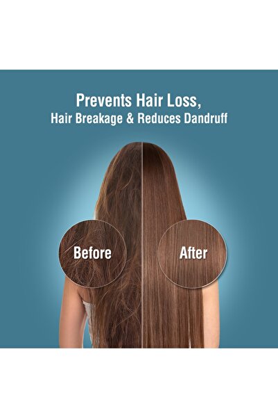 Blu Intelligent Health Solutions Blu Nmc Refill Cartridge For Blu Ionic Shower Filter - Handheld - Combo Pack (6 Piece Value Pack)