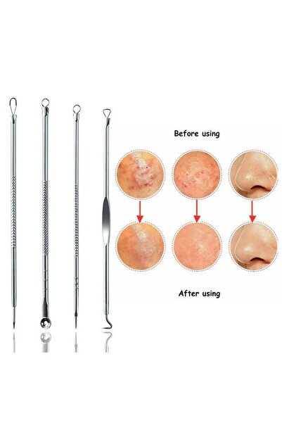 Dahaus Gümüş Komedon Set Siyah Nokta Temizleyici Akne ve Sivilce Iğnesi 4 Adet XLD506