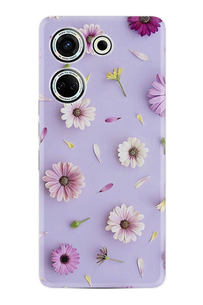 TECNO Camon 20 Kılıf Baskılı xz-07-16 Desenli cmtcno-11.jpg