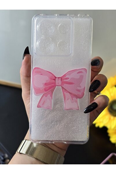 SUPER FRAME Xiaomi Redmi Note 13 Pro 5G Uyumlu Baskılı Şeffaf Telefon Kılıfı