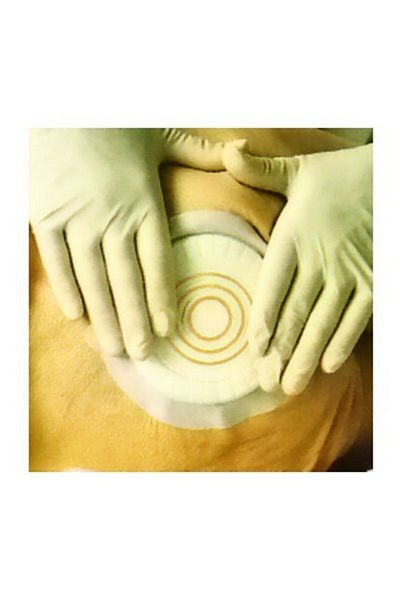 Coloplast 33353 Comfeel Plus - 10 Pieces Pressure Reducing Hydrocolloid Wound Cover 10 Cm