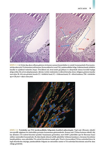 Ema Tıp Kitabevi Klinik Oftalmoloji Renkli Atlas Ve Genel Bakış Glokom