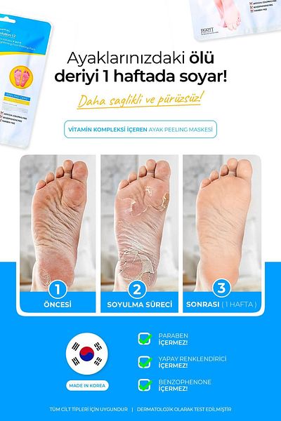 Jigott Sensitive and Effective Peel-Off Foot Peeling Mask with Vitamin B5 for Dead Skin, Stretch Marks