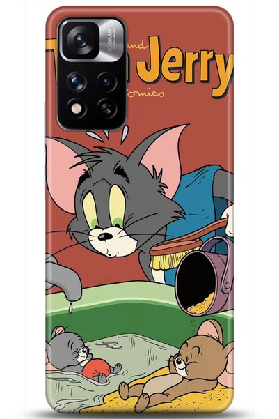 adveksiyon Xiaomi Redmi 11 Pro Plus 5g Case Hd Printed Case - Followed Instit...