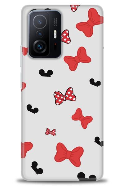 Sitrin Aksesuar حافظة هاتف Xiaomi Mi 11T / Mi 11T Pro مطبوعة بدقة عالية - فيونكة