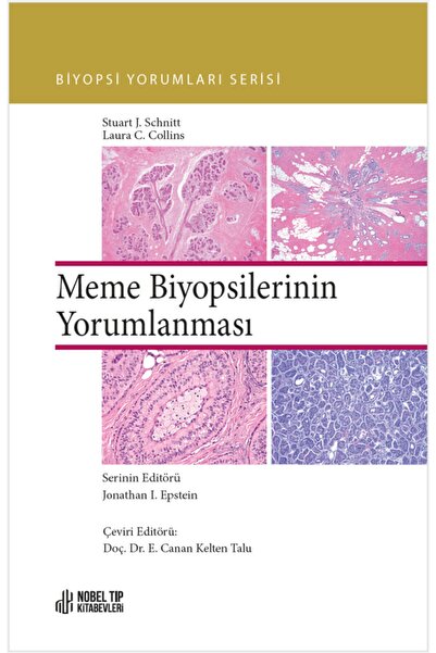 Nobel Tıp Kitabevleri Meme Biyopsilerinin Yorumlanması