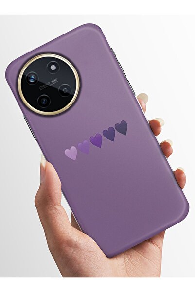 realme 11 Kılıfı Standlı Baskılı Parlak Silikon Kapak - morkalpler