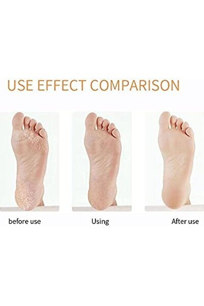 Genel Markalar Diva Camille Ayak Törpüsü Topuk Törpüsü Ayak Rendesi Ayak Bakım Aleti