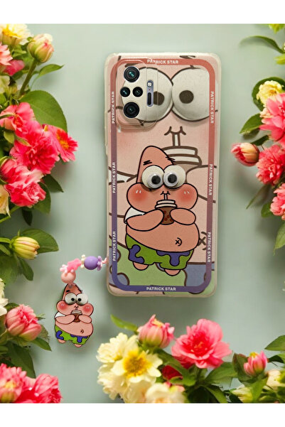 Spoyi Xiaomi Redmi Note 10 Pro Patrik Tasarımlı Charmlı Telefon Kılıfı