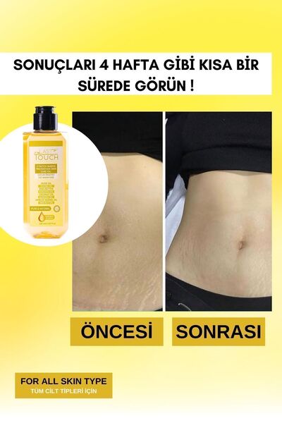 LAST TOUCH Çatlak Önleyici Cilt Bakım Yağı ( Hamilelik-Sporcu Çatlakları-Hızlı Kilo Alıp Verme ) 150 ML