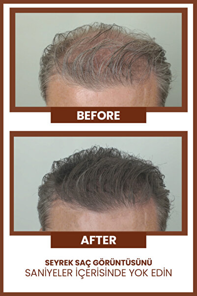 Luis Bien Saç Dolgunlaştırıcı Toz Fiber Kahverengi | Seyrek Saç Kapatıcı & Doğal Hacim