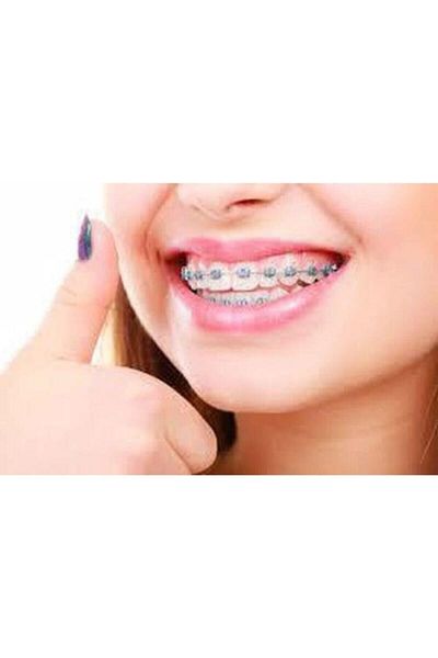 First Class 10 Pieces Orthodontic Candle - Mixed Flavored Brace Bracket Candle