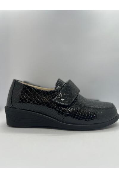 Ortopedia Kadın Deri Hallux Diabetic Ayakkabı 1005 - Siyah Mısır Kroko