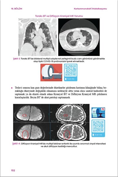 Ema Tıp Kitabevi Dahili Ve Adli Aciller - Enes Güler 9786257849500