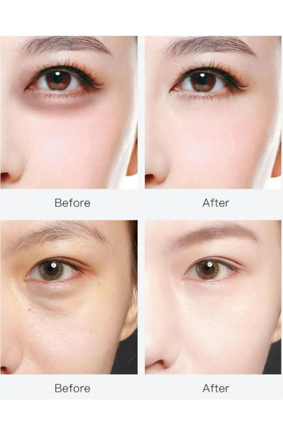 HaLVeY Göz Altı Aydınlatıcı, Sıkılaştırıcı Ve Onarıcı Arbutin Özlü Maskesi Gold 1.4gr*60 Adet