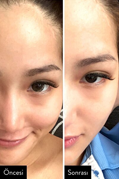 I'm From [mini Boy] Rice Toner (KORENDY) Aydınlatıcı Pirinç Toniği 30ml