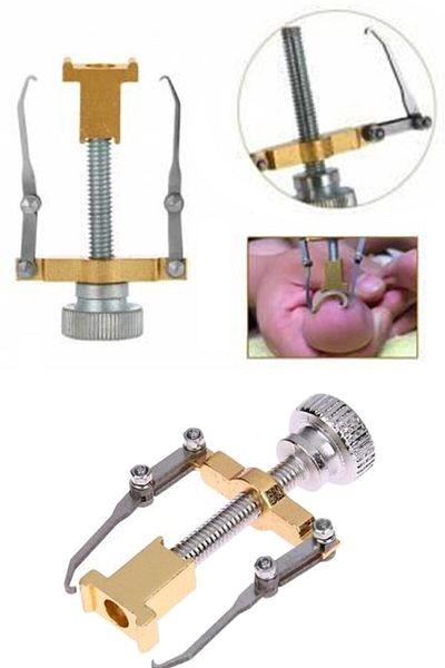 DecoTown Ingrown Nail Correction Tool Ingrown Nail Remover Apparatus