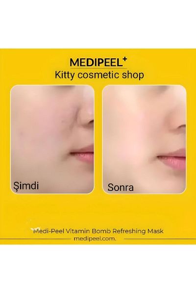 Medipeel Medi-Peel Vitamin Bomb - Curly and Dull Refreshing Mask 1 Piece