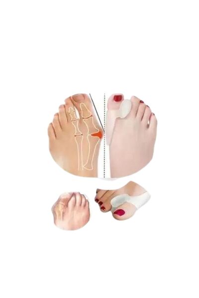 Aps High Quality Silicone Roller Finger Protector Bunion - Hallux Valgus Roller