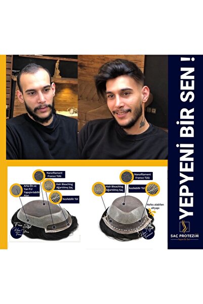 SACPROTEZİM Protez Saç Ancora 6x9 1b %10 Beyazlı Ince Telli Her Yöne Taranabi...
