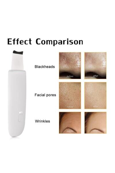 pazariz جهاز تنظيف البشرة بالموجات فوق الصوتية أسود اللون - منظف للبشرة قابل ...