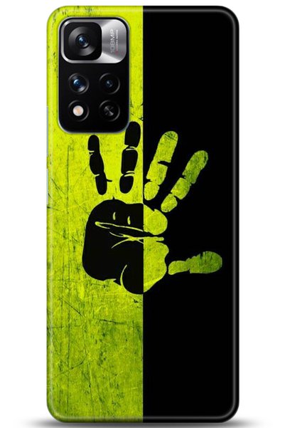adveksiyon Xiaomi Redmi Note 11 Pro Plus 5g Case Hd Printed Case - Followed I...