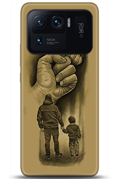 adveksiyon Xiaomi Mi 11 Ultra Kılıf HD Baskılı Kılıf - Followed Institution 0677