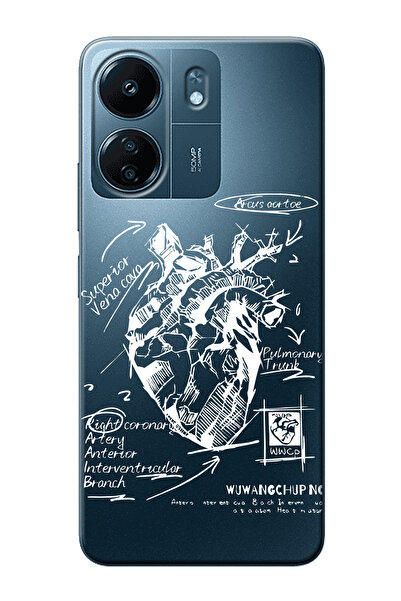 shoptocase Redmi 13C Uyumlu Anatomik Kalp Desenli Şeffaf Telefon Kılıfı