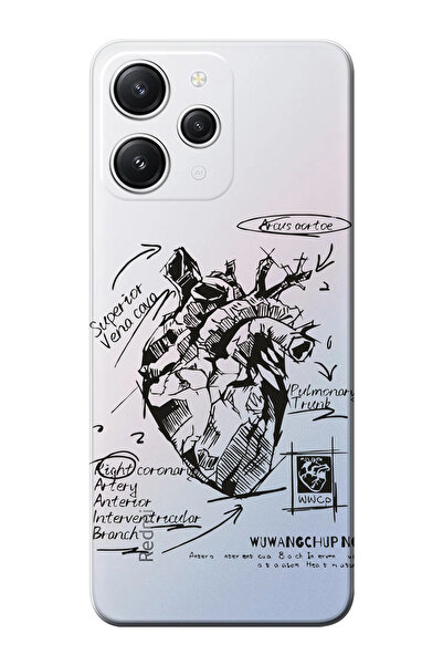 shoptocase Redmi 12 Uyumlu Anatomik Kalp Desenli Şeffaf Telefon Kılıfı