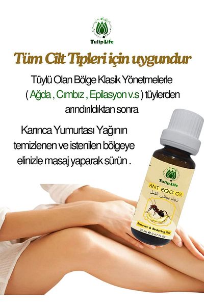 Tuliplife 20 ml Hair Thinning and Reducing Ant Egg Oil