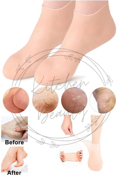 Kitchen Beauty Silikon Ayak Bakım Çorabı Nemlendirici Jel Çorap Çatlak Önleyi...