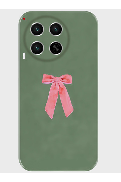 TECNO Camon 30 Kılıf Baskılı Silikon Kapak - 29