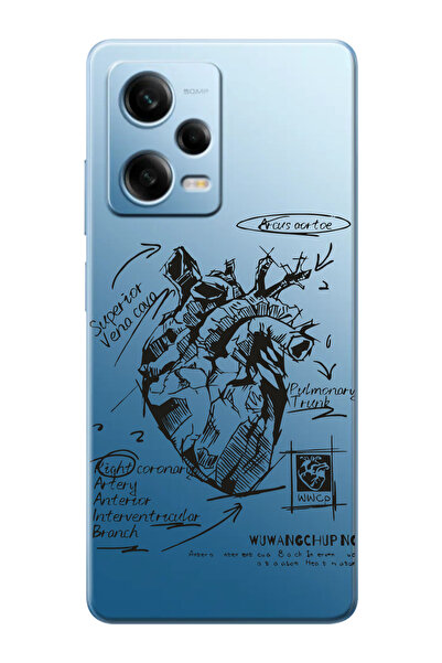 shoptocase Redmi Note 12 Pro 5G Uyumlu Anatomik Kalp Desenli Şeffaf Telefon K...