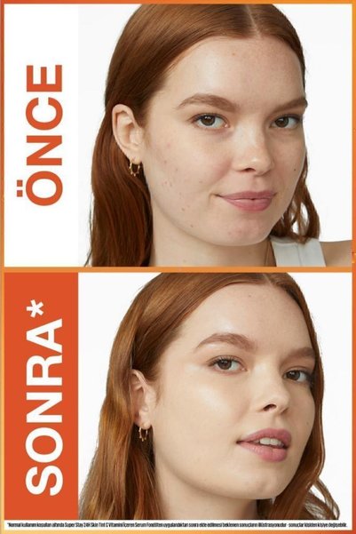 Maybelline New York Super Stay Skin Tint Fondöten - 10
