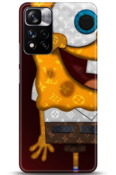 adveksiyon Xiaomi Redmi Note 11 Pro Plus 5g Case Hd Printed Case - Followed I...