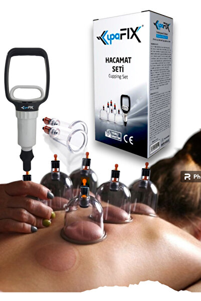 HACAMATSEPETİ 6 Lı Hacamat Seti, Vakumlu Hacamat Kupası, Masaj Seti, Hacamat Kupası Ve Pompası