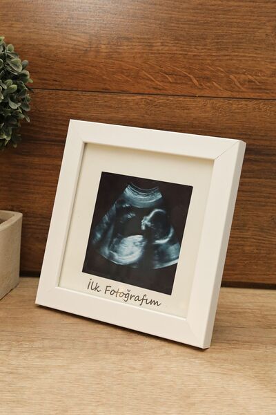 Aksesuar ZD Store İlk Fotoğrafım Bebek Ultrason Çerçevesi Beyaz