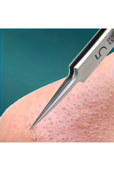 SYNOPE Paslanmaz Çelik Siyah Nokta Ve Leke Temizleyici Çıkarma Araçları Siyah Nokta Cımbızı