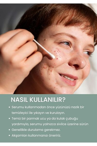 Ixora Anti-Acne Drying Local Gel 30 ml